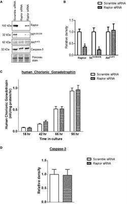 mTORC1 Transcriptional Regulation of Ribosome Subunits, Protein Synthesis, and Molecular Transport in Primary Human Trophoblast Cells